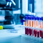 Immagine fotorealistica di un moderno laboratorio di analisi con provette di sangue in primo piano su un bancone e strumentazione avanzata sfocata sullo sfondo, simboleggiando la diagnosi dell'epatite delta. Prime lens, 50mm, depth of field, luce controllata e brillante.