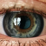 Immagine macro, obiettivo 105mm, di un occhio umano che mostra i dettagli della cornea, con un leggero edema visibile che ne riduce la trasparenza. Illuminazione controllata per enfatizzare la texture e le sottili imperfezioni. Messa a fuoco precisa, alta definizione, sfondo leggermente sfocato per concentrare l'attenzione sull'occhio.