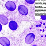 Immagine fotorealistica al microscopio elettronico di diverse vescicole sinaptiche all'interno di un terminale nervoso, alcune attraccate alla membrana presinaptica. Obiettivo macro 105mm, alta definizione, messa a fuoco precisa, illuminazione controllata che evidenzia le strutture subcellulari e le membrane lipidiche. L'immagine simboleggia lo studio approfondito delle vescicole nell'invecchiamento e nelle sinucleinopatie come il Parkinson.
