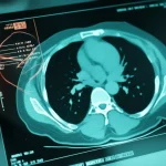 A photorealistic image depicting an AI system interface overlayed on a CT scan, clearly highlighting bone metastases. The scene should convey advanced technology and precision in a medical context. Use a prime lens, 35mm, with depth of field, perhaps in duotone (e.g., teal and orange) to emphasize the tech aspect.