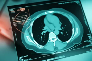 A photorealistic image depicting an AI system interface overlayed on a CT scan, clearly highlighting bone metastases. The scene should convey advanced technology and precision in a medical context. Use a prime lens, 35mm, with depth of field, perhaps in duotone (e.g., teal and orange) to emphasize the tech aspect.