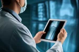 Immagine fotorealistica di un chirurgo ortopedico che esamina un modello 3D interattivo di un ginocchio su un tablet trasparente futuristico, sovrapposto a una radiografia sfocata sullo sfondo. L'immagine combina elementi medici e tecnologici, illuminazione da studio controllata, lente prime 50mm, alta definizione.