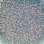 Immagine macro ad alta definizione di colonie del batterio Saccharopolyspora spinosa che crescono su un terreno di coltura in una piastra di Petri, con illuminazione controllata per evidenziare la texture e il colore delle colonie, alcune delle quali potrebbero mostrare una pigmentazione rosata o grigiastra tipica delle spore. Lunghezza focale macro 60-105mm, alta definizione, messa a fuoco precisa.
