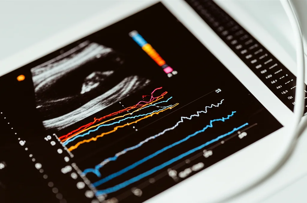 Immagine macro di un referto di ecografia Doppler fetale con grafici di flusso sanguigno colorati. Lente macro 100mm, alta definizione dei dettagli, illuminazione controllata per enfatizzare le texture della carta e la chiarezza dei grafici. Focus preciso sui valori numerici e sulle curve Doppler.
