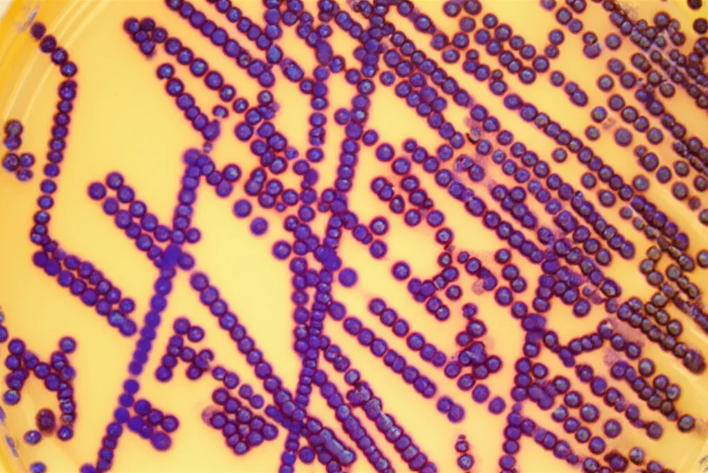 Immagine macro ad alta definizione di colonie di Acinetobacter baumannii su una piastra di agar sangue in un laboratorio di microbiologia, illuminazione controllata per evidenziare la morfologia delle colonie, obiettivo macro 100mm, messa a fuoco precisa.