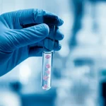 Immagine fotorealistica concettuale che mostra una mano guantata da ricercatore che tiene delicatamente una provetta contenente cellule staminali mesenchimali luminose (simbolo di potenza terapeutica) su uno sfondo sfocato di un laboratorio high-tech. Lente prime, 35mm, profondità di campo ridotta, illuminazione drammatica che evidenzia la provetta, toni blu e bianchi duotone per un look scientifico e pulito.