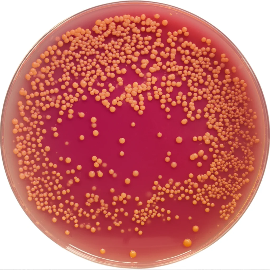 Macro fotografia di colonie rosa-arancioni brillanti del lievito Rhodotorula mucilaginosa che crescono su una piastra di agar in un laboratorio di microbiologia. L'illuminazione è controllata per evidenziare la texture mucoide delle colonie, obiettivo macro 60mm, alta definizione e messa a fuoco precisa.