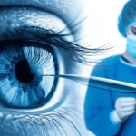 Immagine composita che mostra un occhio umano con sovrapposte mappe di aberrazione colorate e un chirurgo che esegue un intervento LASIK, alta tecnologia, precisione medica, lente prime 35mm, duotone blu e argento, profondità di campo.