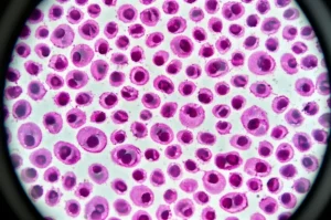 Immagine fotorealistica di cellule staminali mononucleate da sangue di cordone ombelicale illuminate al microscopio, alta definizione, obiettivo macro 105mm, illuminazione controllata, che simboleggia la ricerca sulla terapia cellulare per la sindrome del cuore sinistro ipoplasico.