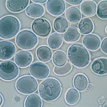 Macro lens, 100mm, high detail, precise focusing, controlled lighting of Aspergillus fumigatus spores under a microscope.