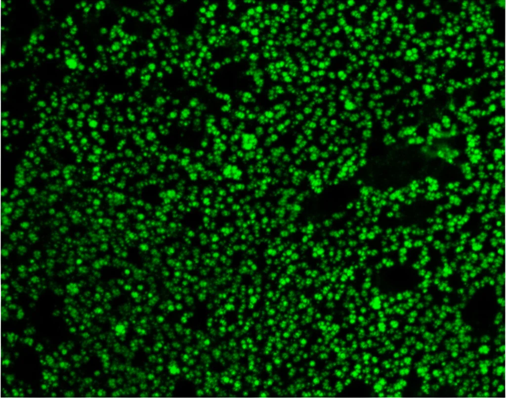 Visualizzazione microscopica ad alta risoluzione del tessuto cerebrale ippocampale di un paziente con Alzheimer, che mostra un'elevata espressione della proteina ELK1 evidenziata con colorazione immunofluorescente verde brillante contro uno sfondo scuro. Obiettivo macro, 100mm, illuminazione controllata, alta definizione.