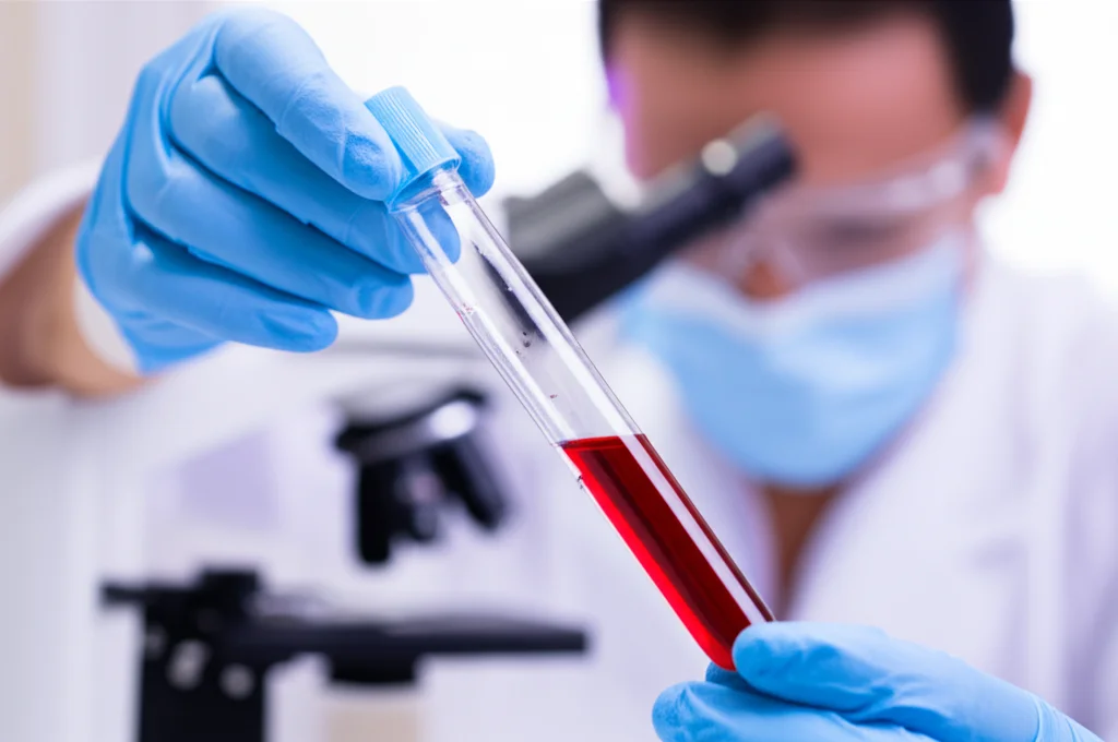Fotografia di una provetta di sangue in un laboratorio di analisi, con un tecnico sullo sfondo sfocato. Luce controllata, messa a fuoco precisa sulla provetta, obiettivo macro 60mm, per simboleggiare l'analisi dei biomarcatori come il CLR.