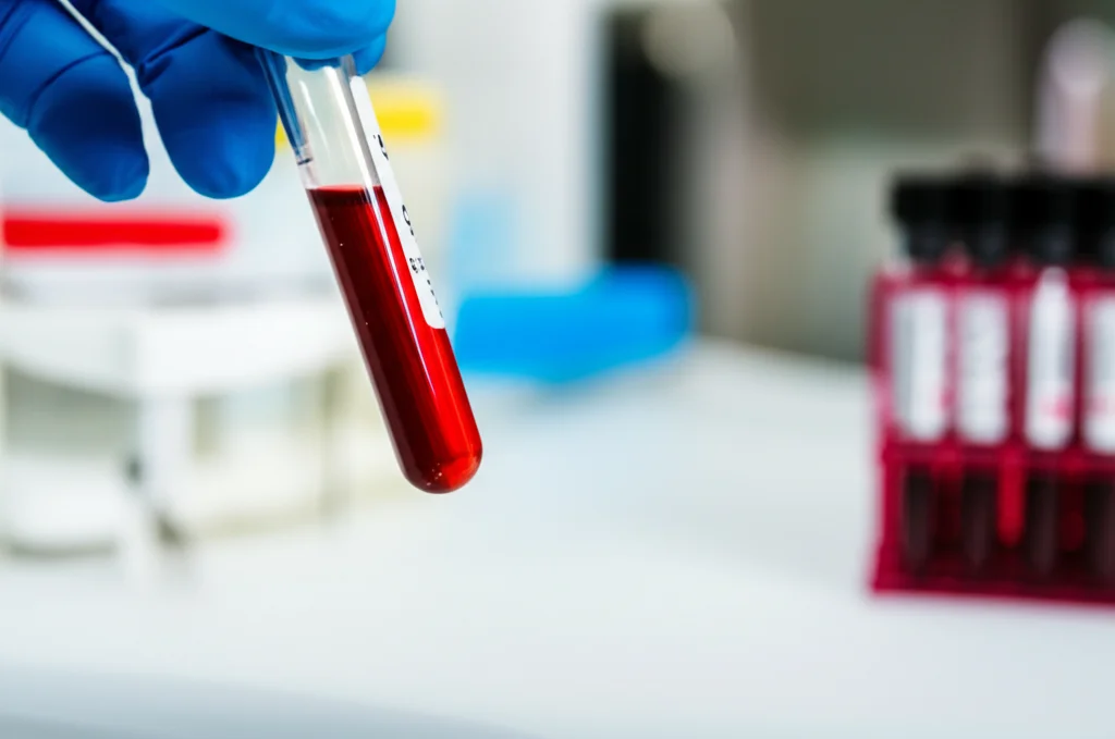 Primo piano di una provetta di sangue in un laboratorio di analisi mediche, luce controllata, obiettivo macro 90mm, alta definizione dei dettagli del siero e delle cellule sanguigne separate.