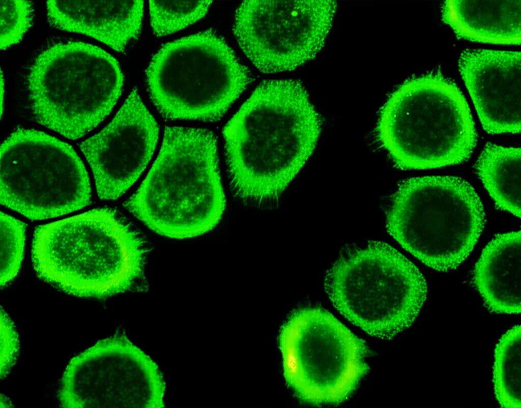 Microscopia a fluorescenza che mostra cellule di lievito Komagataella phaffii che esprimono la proteina fluorescente verde (eGFP). Colori vivaci verde brillante su sfondo scuro, alta risoluzione, dettaglio cellulare visibile.