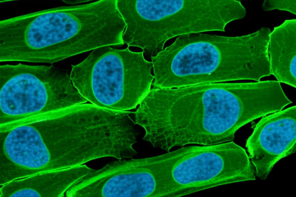 Fluorescent microscopy image showing plant cells with distinct, bright green FUST1 condensates forming rapidly upon heat exposure, macro lens, 60mm, high detail, precise focusing, controlled lighting.