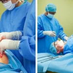 Photorealistic image showing a split view: one side depicts a surgeon performing laparoscopic adrenalectomy (TLA) in a lateral position, the other side shows a surgeon performing retroperitoneoscopic adrenalectomy (PRA) in a jack-knife position. High detail, precise focusing, controlled lighting.