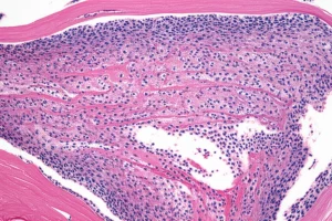 Microscopic view of inflamed synovial tissue in a knee joint, highlighting cellular interactions causing inflammation. Macro lens, 100mm, high detail, precise focusing, controlled lighting.