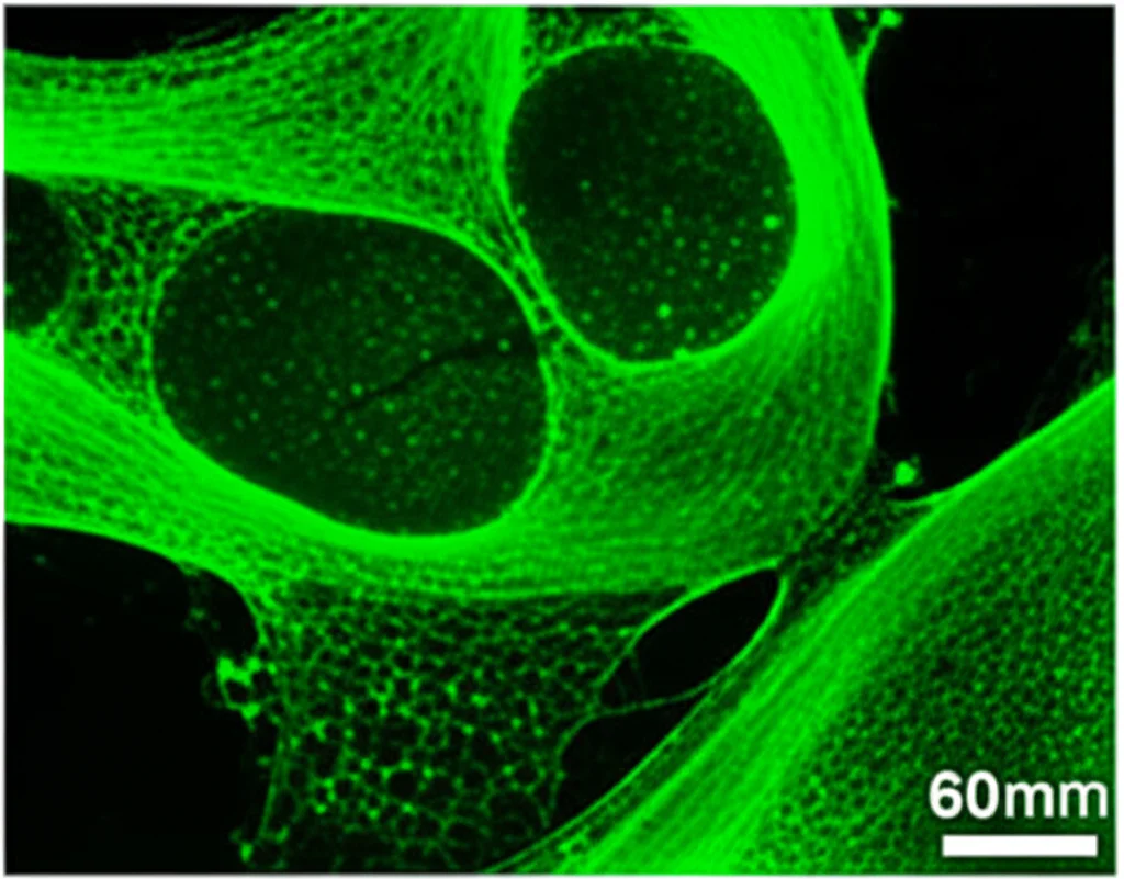 Microscopic view showing green (F4/80, macrophage marker) and red (Arg-1, M2 marker) co-localized cells, indicating M2 macrophages in healing tissue, immunofluorescence staining, macro lens, 60mm, high detail.