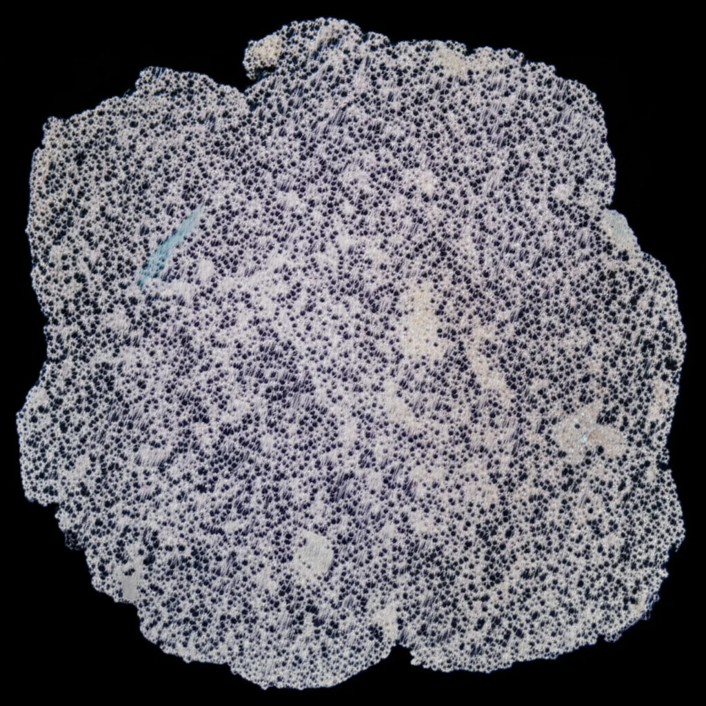 Close-up comparison of Type II and Type III papillary kidney stones, 105mm macro lens, emphasizing the differences in crystal structure (COM vs COD) and the presence of calcified renal tubules, high detail, precise focusing, controlled lighting.