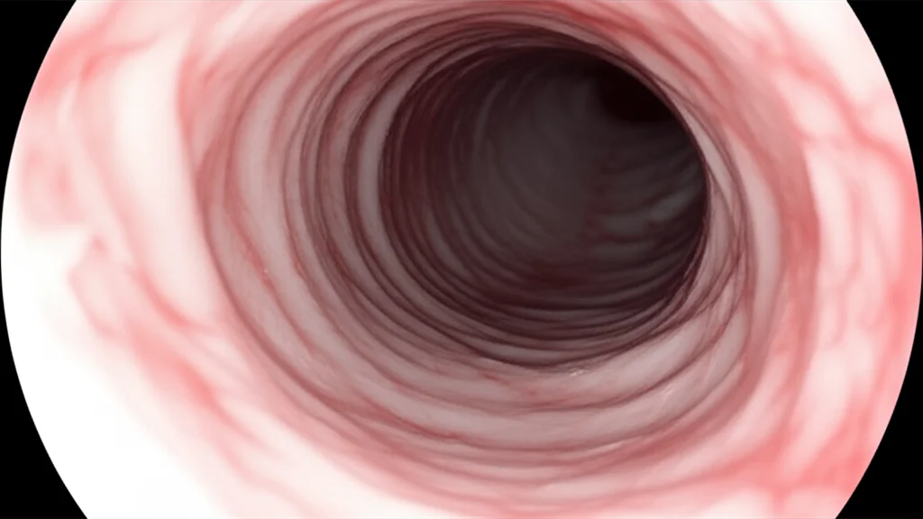 Close-up view inside a human airway during bronchoscopy, macro lens, 60mm, high detail, controlled lighting, showing a narrowed section