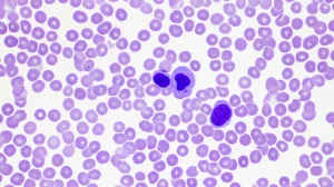 Microscopic view of abnormal blood cells (monocytes and blasts) characteristic of CMML, macro lens, 100mm, high detail, precise focusing, controlled lighting.